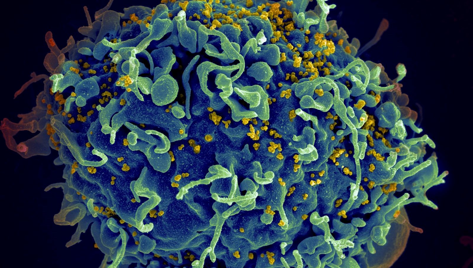HIV Tedavisinde Yeni Bir Dönem: mRNA Tabanlı Yöntemler Umut Vaadediyor!