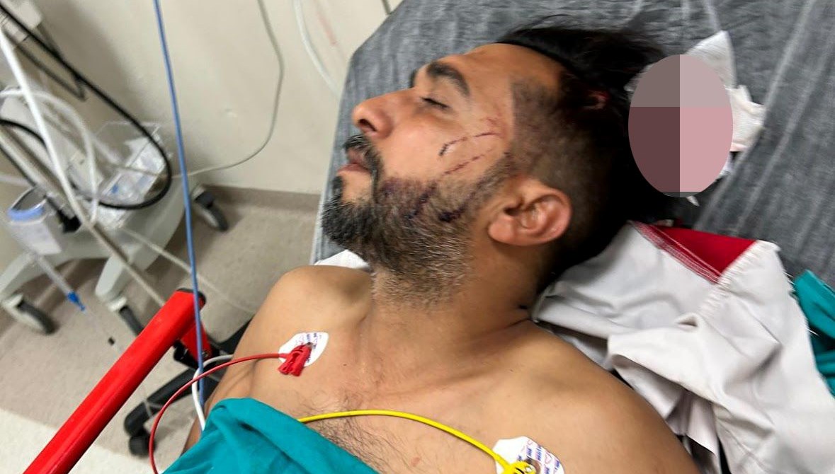 Yorgun Mermi: Tavanı Delip Ustaya Hedef Oldu!