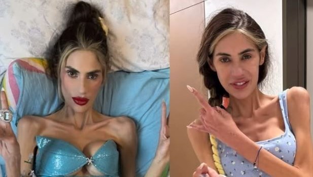 Nihal Candan: Anoreksiya ile Savaşan Gencin Hayatı ve Son Durumu Nedir?