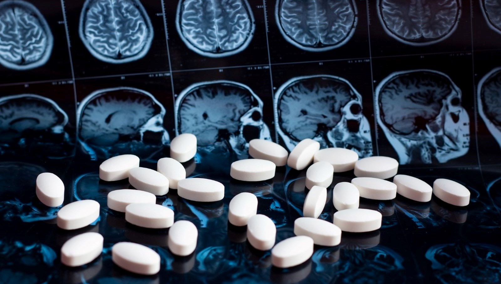 Günde Bir Hap ile Alzheimer'a Umut Işığı: Klinik Testler Başladı!
