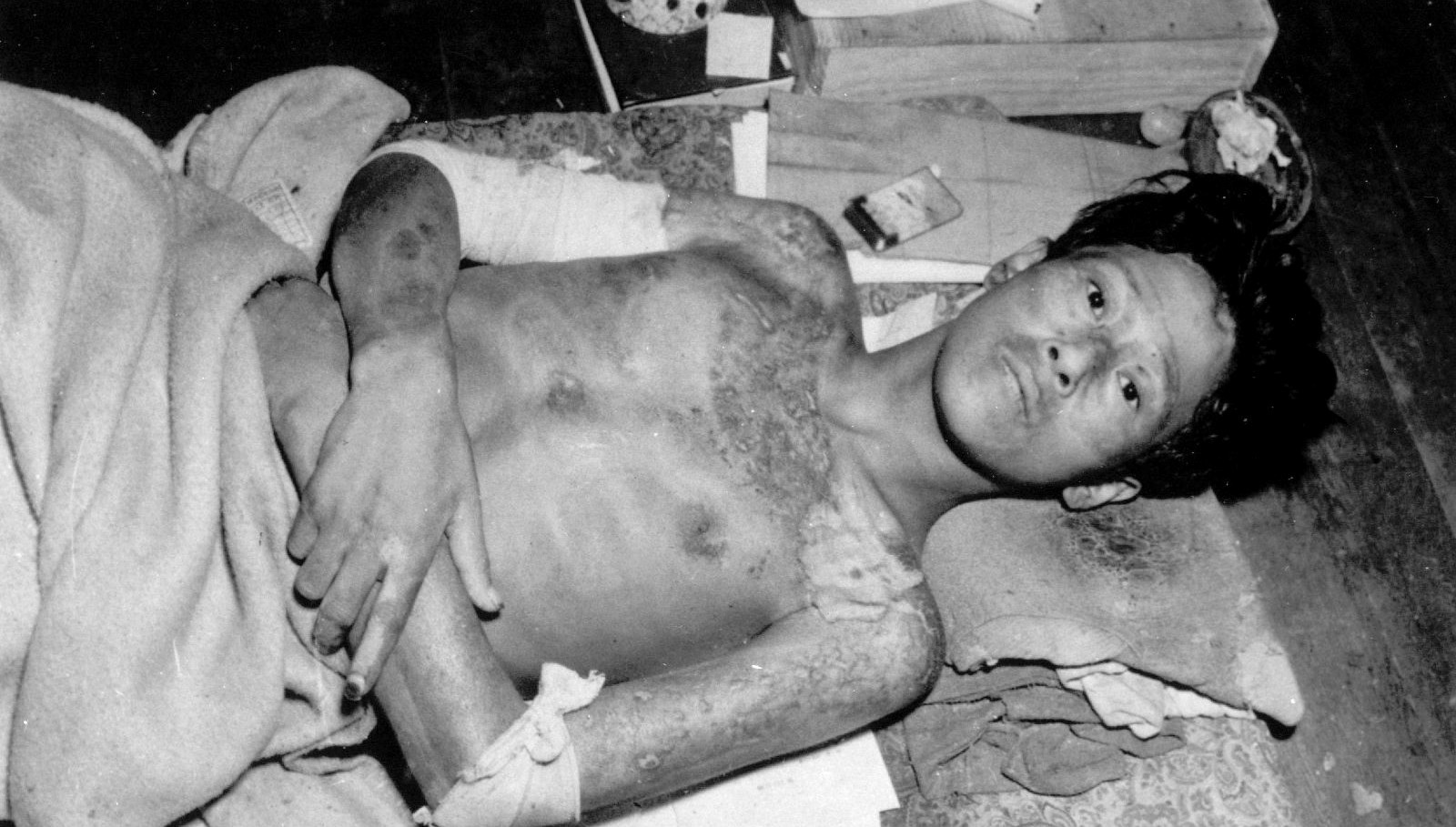 Nagasaki’den 80 yıl sonra alarm: Nükleer tehlike kapımızda!