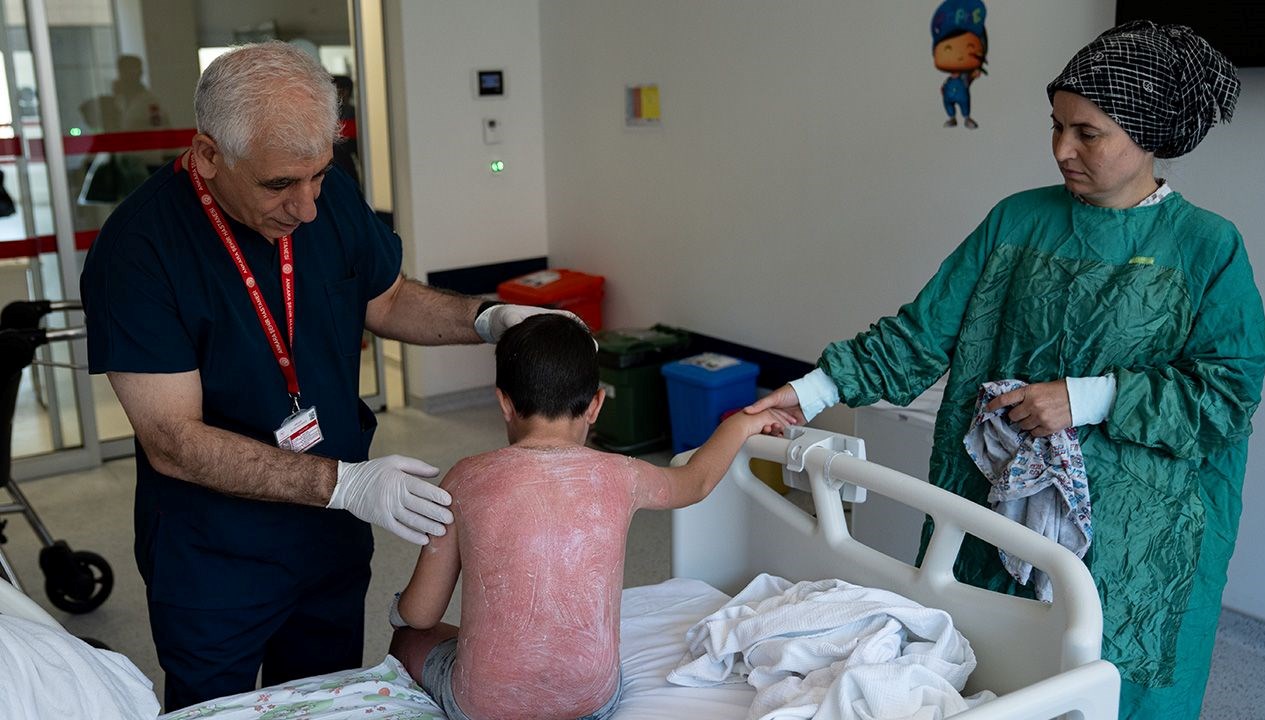 Güneşte Fazla Kalan Çocuk Hastaneye Kaldırıldı!