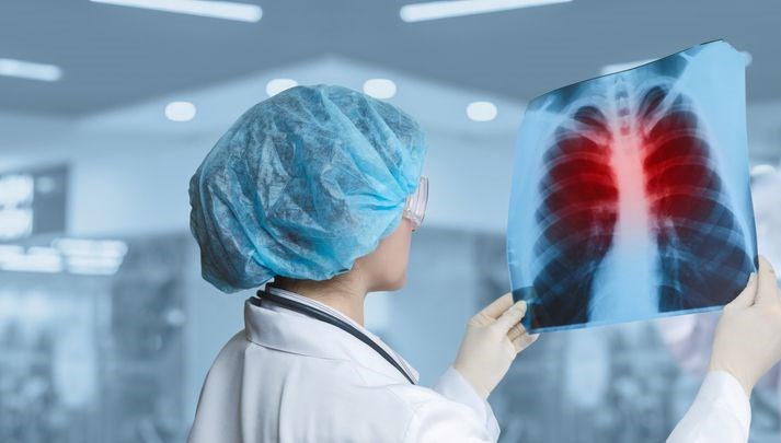 Zatürre Belirtilerine Dikkat: Hastaneye Acil Gidişi Gerektiren 8 İşaret!