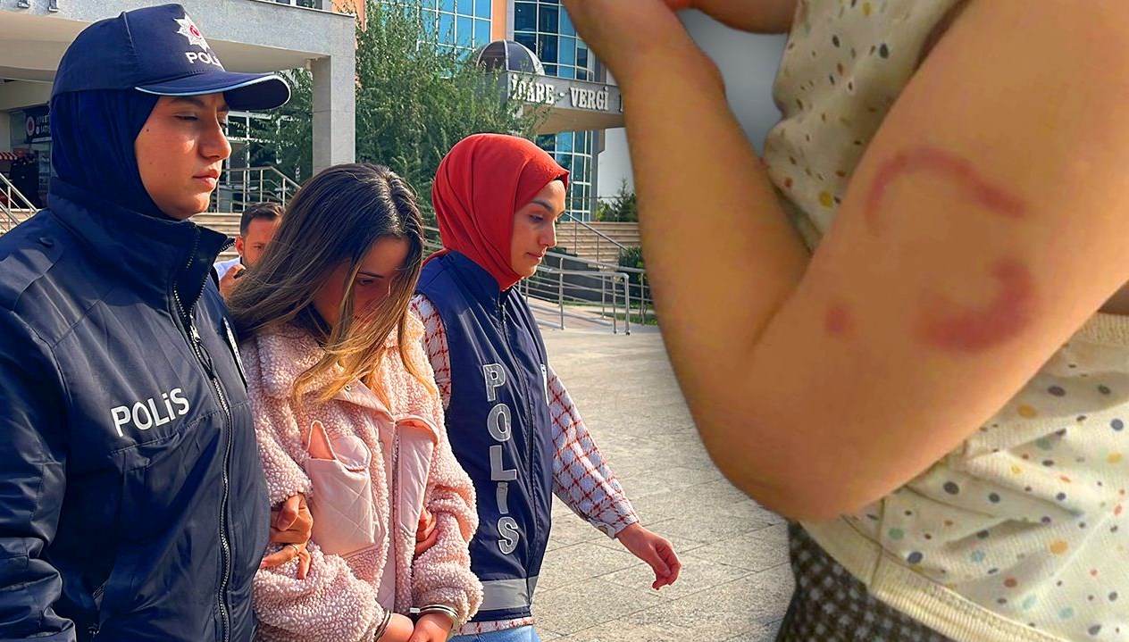 Kreşte Şok Edici Olay: Bakıcının Çocuğu Isırması Üzerine Verilen Karar Açıklandı
