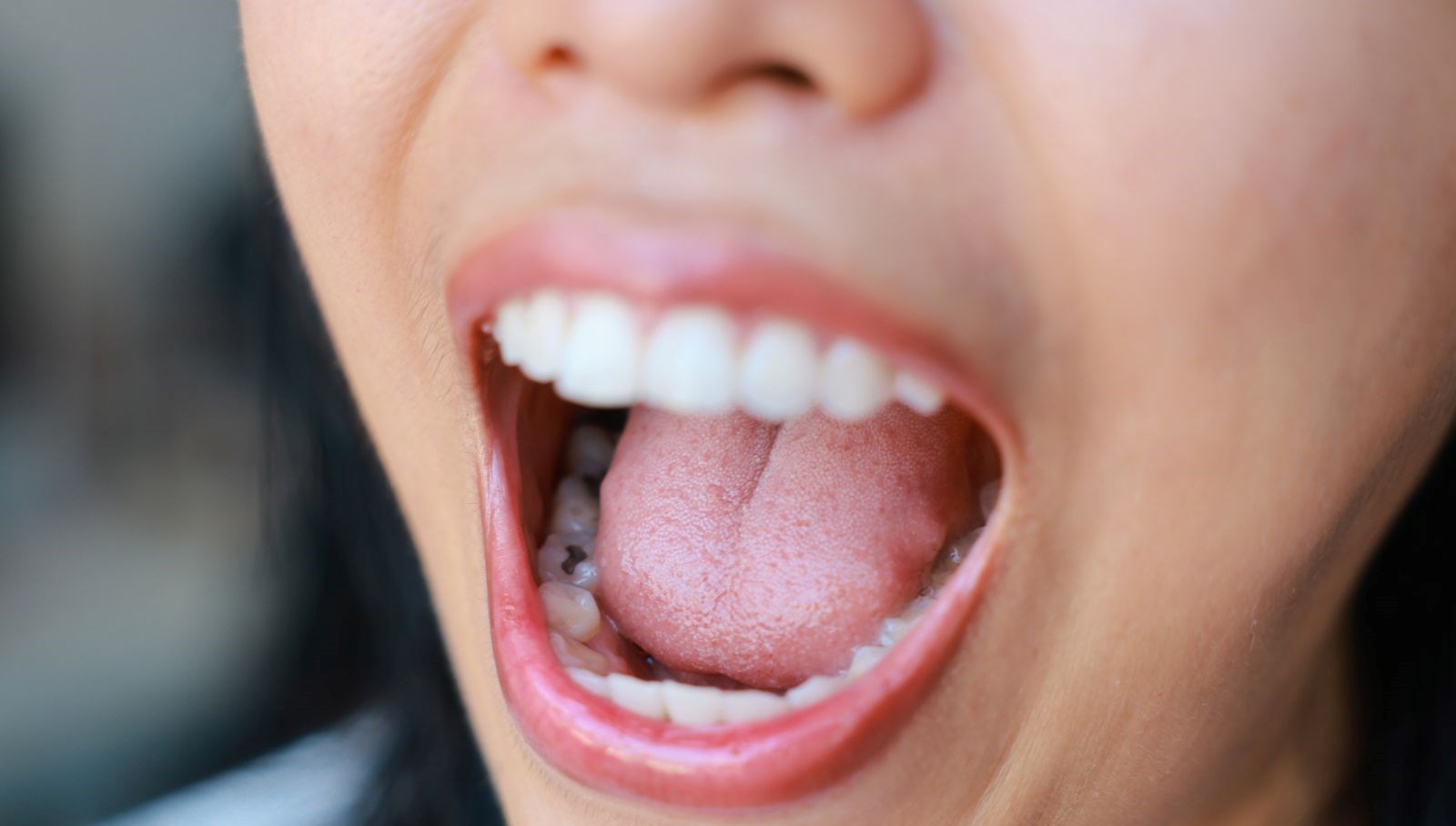 Dil Kaslarındaki Değişiklikler: Ölümcül Hastalığın İlk Belirtilerine Dikkat!