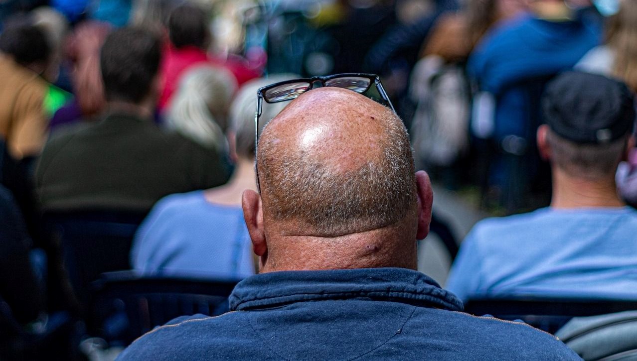 Saç Dökülmesine Veda: 20 Günde Gözle Görülen Güçlü Etki!